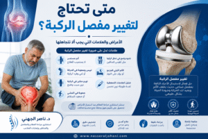 متى تحتاج لتغيير مفصل الركبة - جراحة استبدال الركبة