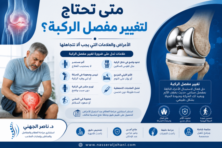 متى تحتاج لتغيير مفصل الركبة - جراحة استبدال الركبة